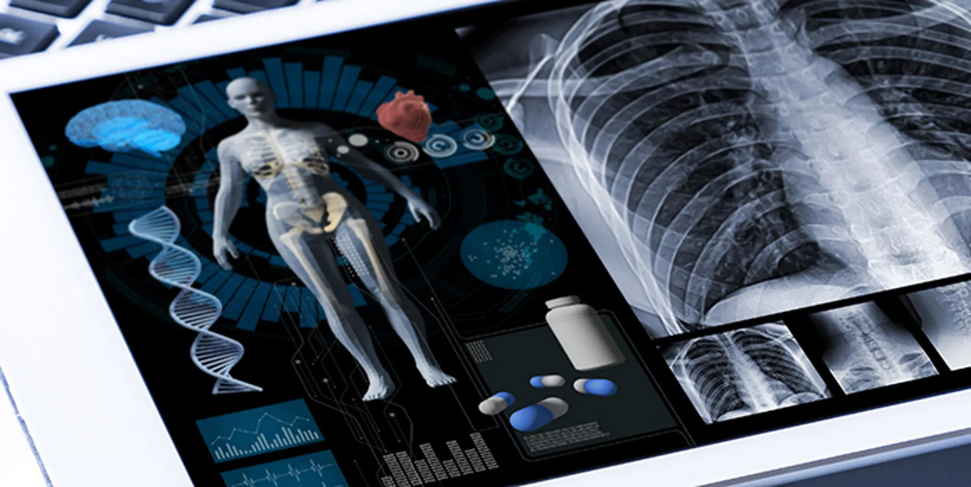 Precision Medicine（プレシジョン・メディシン）の普及における